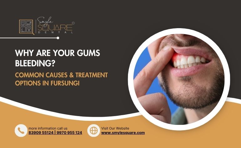 Why Do NRIs Prefer Getting Their Dental Treatment in India